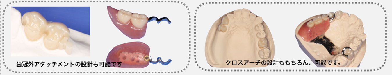 �A�^�b�`�����g�Z�H�i���ȋZ�H���A�j