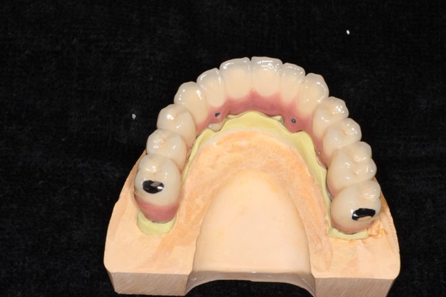 ��t���D���s�ŃC���v�����g�Z�H